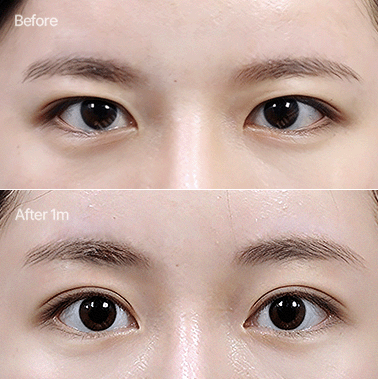 이마거상+자연유착