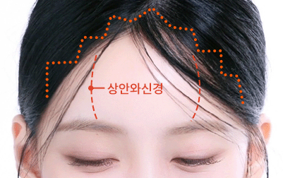 상안와신경 보존