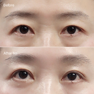 이마거상